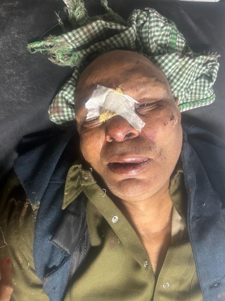 जब पूरा हरियाणा 12 नवंबर को अपने परिवार के साथी दिवाली मना रहा था तब रोडवेज का प्रत्येक कर्मचारी अपनी ड्यूटी पर तैनात था
अंबाला कैंट बस स्टैंड कार्यरत चालक राजबीर D152 की 4-5 गुंडों द्वारा पीट-पीट मौत के घाट उतार दिया।
राजबीर के हत्यारों को गिरफ्तार करो
<a href="/cmohry/">CMO Haryana</a>
<a href="/anilvijminister/">Anil Vij Ambala Cantt Haryana, India</a>