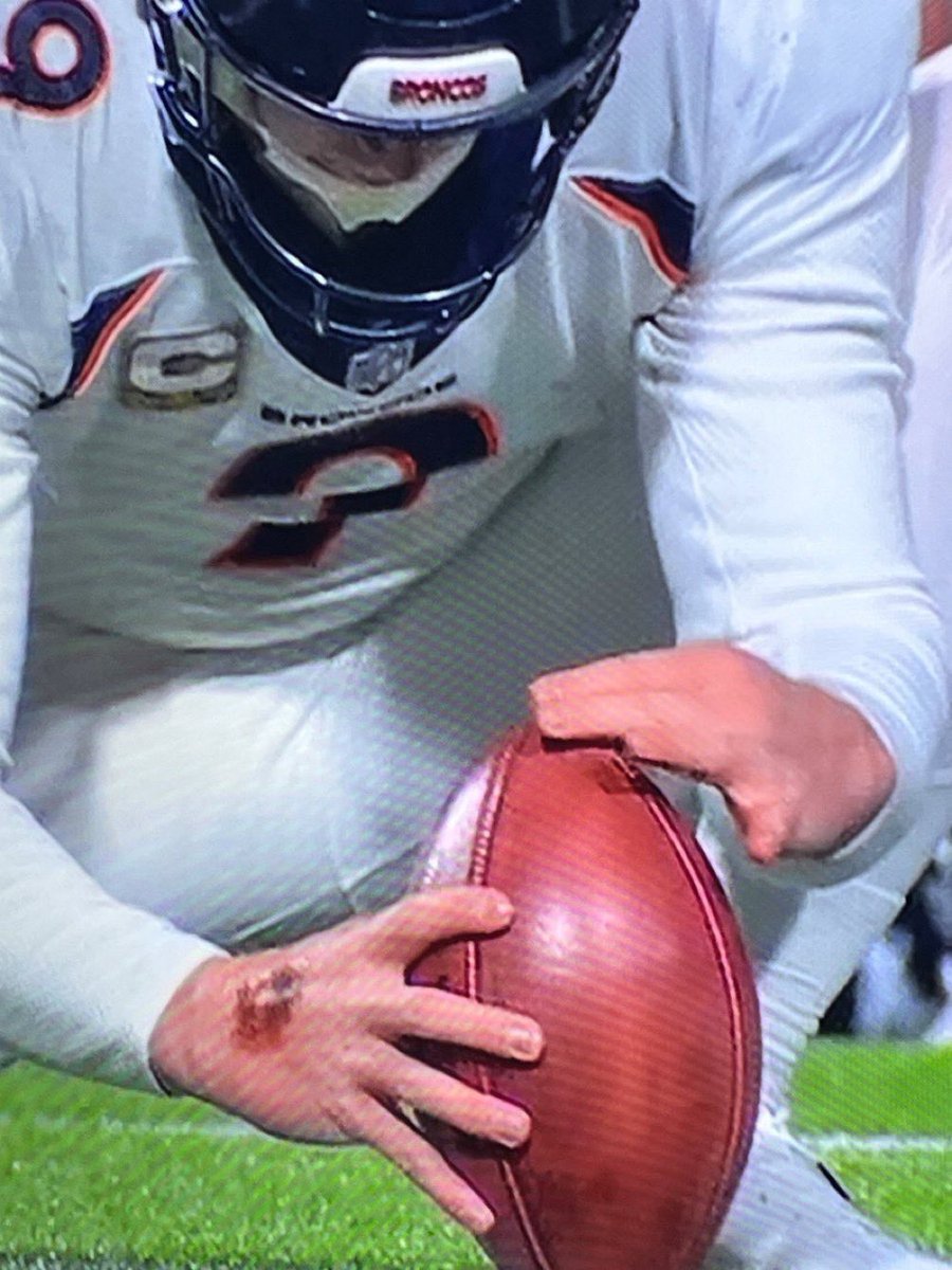 MLFootball's tweet photo. TRENDING: #Bills fans are calling out the #Broncos holder for having SPIDER TACK on his hand to help handle the ball

👀

(📸 @SethHachmeister) https://t.co/iOeoqfWO4n