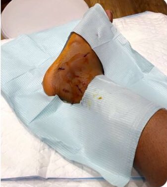 HL122333's tweet image. ادعاء الاصابة والكذب والخيانة 
والتهرب المتكرر من معسكرات المنتخب 
 يتكرر مع سالم الدوسري !!

يجب التحقيق مع اللاعب والجهاز الطبي 
والمسؤولين عن المنتخب في هذا التستر والخيانة .