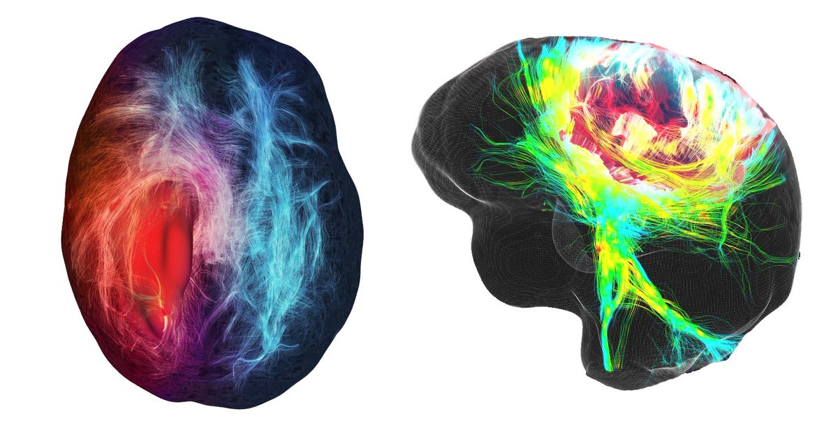 Maxime Chamberland (@maxchamb) on Twitter photo 2 weeks left to apply for this PhD position. Come join the #Visualization cluster <a href="/TUeindhoven/">TU Eindhoven</a>
jobs.tue.nl/en/vacancy/phd…
#tractography #Neuro #AcademicTwitter 2 weeks left to apply for this PhD position. Come join the #Visualization cluster <a href="/TUeindhoven/">TU Eindhoven</a>
jobs.tue.nl/en/vacancy/phd…
#tractography #Neuro #AcademicTwitter