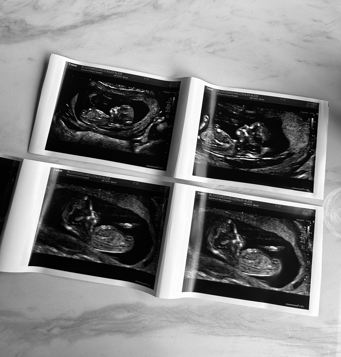 Alice Conlin tweet media