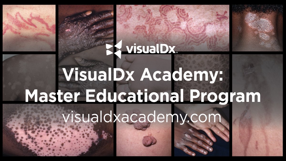 📣 Have you registered to join the VisualDx Academy? Sign up to access ALL archive and future content of our webinar programs. This includes live and on-demand learning, additional exclusive content, and streamlined access. Join today at visualdxacademy.com #meded #derm