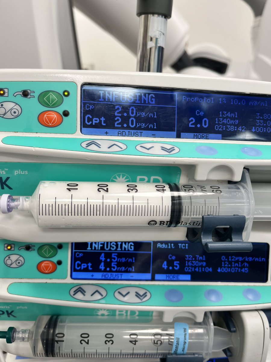 Vin Vyapury (@bluntingstress) on Twitter photo How do you go about this? Highly suppressed pEEG, loss of alpha band but when titrating the propofol down to 1.9, the SEF and BIS both shoot up 🤷🏾♂️ <a href="/Chronotrope/">Mark Barley</a> <a href="/TIVAuk/">𝘿𝙧 𝙍𝙤𝙝𝙞𝙩 𝙅𝙪𝙣𝙚𝙟𝙖 💉 😷</a> <a href="/SIVAnaesthesia/">SIVA</a> How do you go about this? Highly suppressed pEEG, loss of alpha band but when titrating the propofol down to 1.9, the SEF and BIS both shoot up 🤷🏾♂️ <a href="/Chronotrope/">Mark Barley</a> <a href="/TIVAuk/">𝘿𝙧 𝙍𝙤𝙝𝙞𝙩 𝙅𝙪𝙣𝙚𝙟𝙖 💉 😷</a> <a href="/SIVAnaesthesia/">SIVA</a>