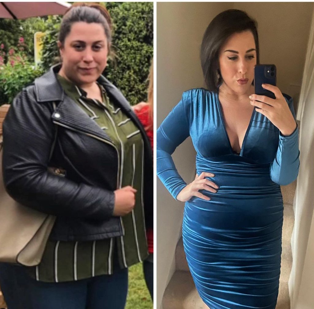 REPOST @saylessweighless 'I did it for her ❤️🥰 ✨ Gastric Sleeve Dec 2022 with Tonic ✨ 87lb down and counting' Inspirational Laura! Start your weight loss journey today. Get in touch with our friendly Tonic team for more info. #GivingBackLives
