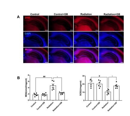 Research Article #EarlyOnline

Radioprotective effect of Ginkgolide B on brain: The mediating role of DCC/MST1 signaling

bit.ly/40zKGxQ

#ijrb #ResearchJournals #research #radiation #science