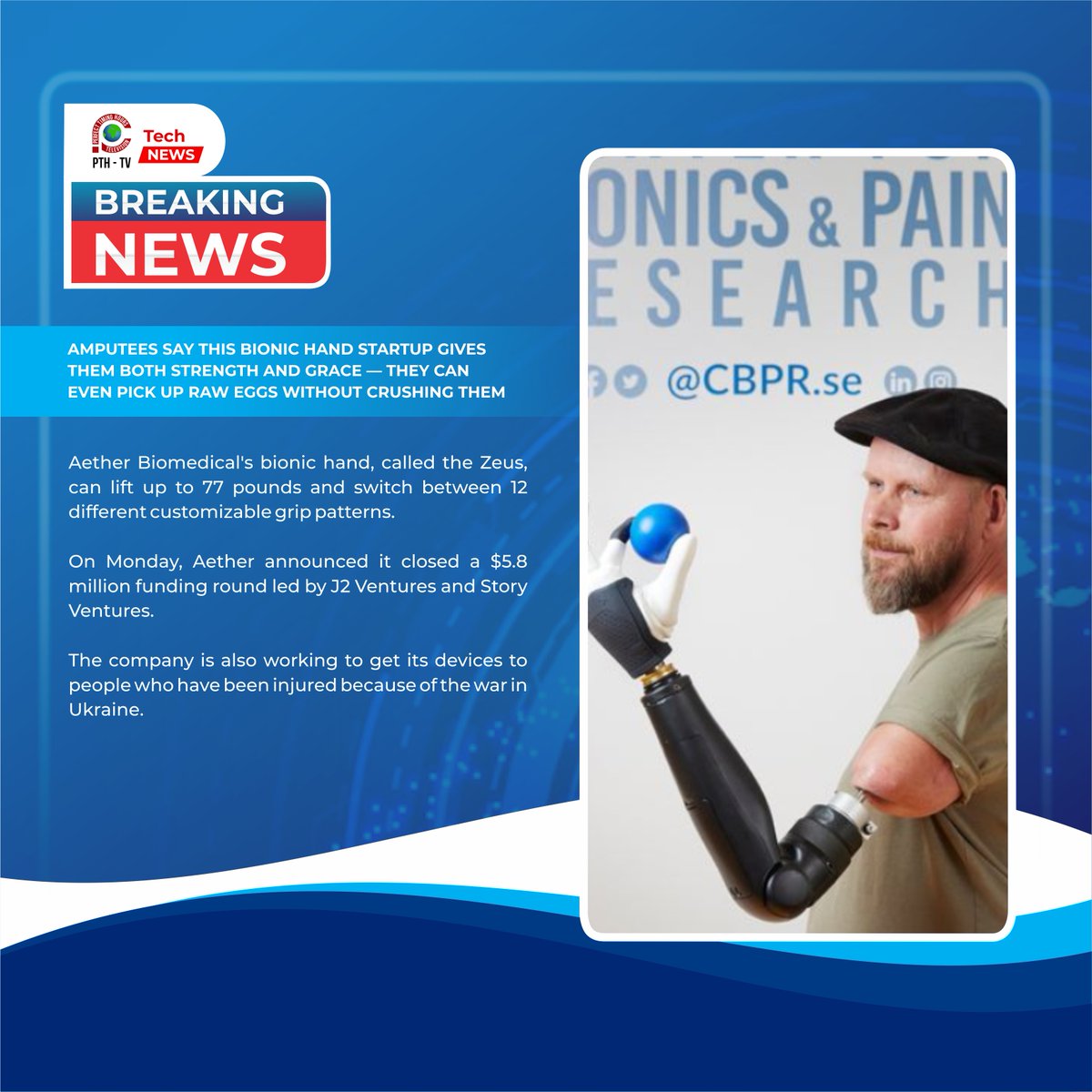 pthtvglobal's tweet image. AMPUTEES SAY THIS BIONIC HAND STARTUP GIVES THEM BOTH STRENGTH AND GRACE — THEY CAN EVEN PICK UP RAW EGGS WITHOUT CRUSHING THEM

Read here: cnbc.com/2023/11/13/aet…

#BionicHand #ProstheticsInnovation #InnovationInHealthcare #PerfectTimingTechnologies #PerfectTimingHolding