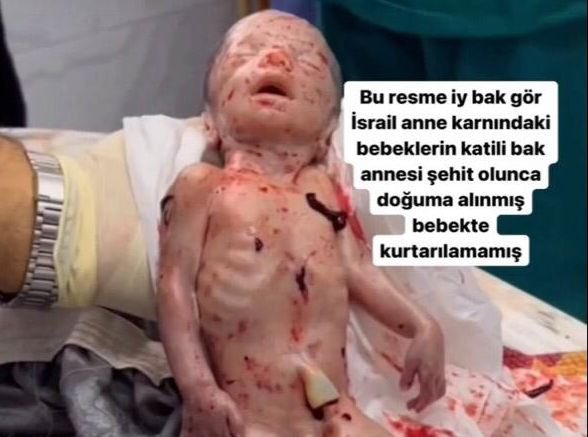 BirnurYagiz's tweet photo. Daha doğmamış Filistinli çocuklar bile bu alçaklar için bir hedef! 

Canilikte sınır yok bu lanetli kavimde sınır yok!!!

#Palestine #TürkiyeMüslümandır 
#FreeGaza #Gaza_under_attack
#Ebu_Ubeyde #KassamTugayları
 #FreePalestineFromIsrael https://t.co/5nReYdZv2p