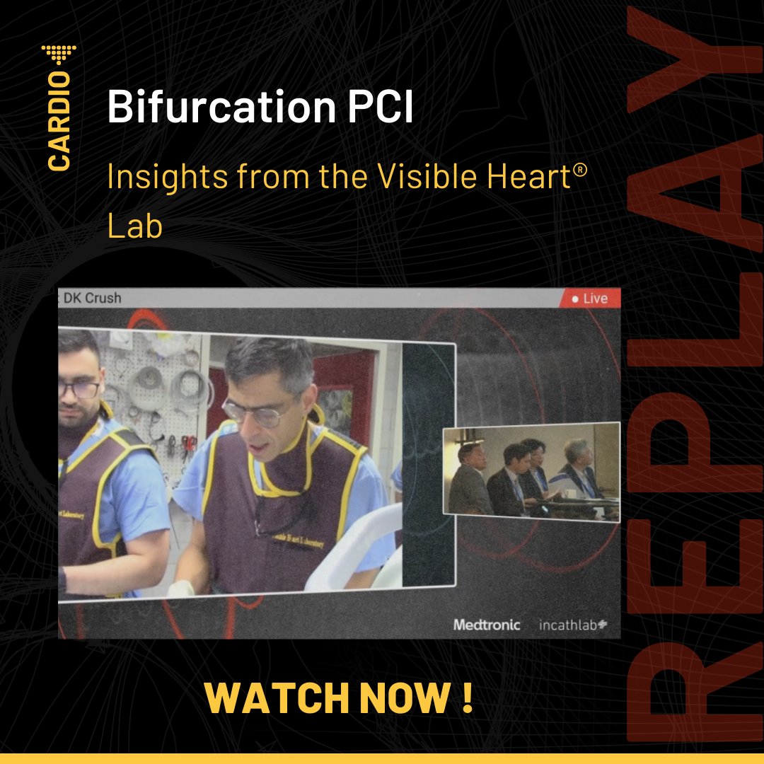 📌 You missed our live case on Bifurcation PCI - Insights from the Visible Heart Lab ? Watch the replay now ➡️ swll.to/ghqgr In collaboration with @Medtronic and @VisibleHeartLab #Bifurcation #PCI