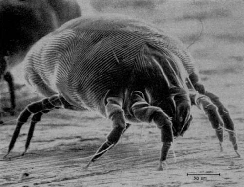 For those with #allergies, #dustmites are a scourge. Fascinating new evidence suggests activity of their #proteases on #skin may be to blame ow.ly/1Ypu50Q7oqX. #dermtwitter #medderm
Image credit: Employee of US Government, Public domain, via Wikimedia Commons