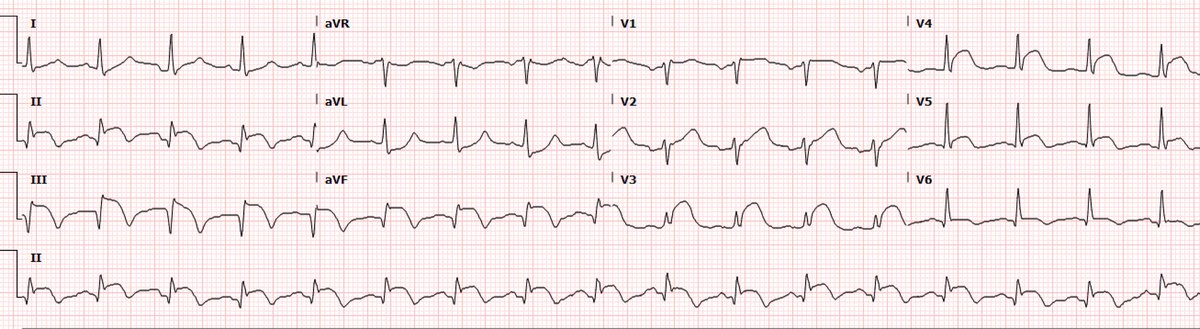 Tareq Alyousef tweet media