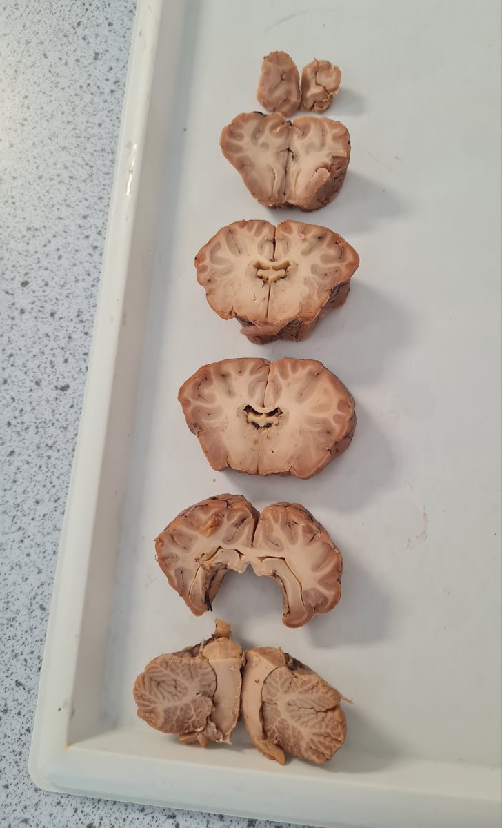 Sheep brain dissection with my #MedicalSciences students. Some important differences between sheep and human brains, but the many similarities are incredible #basalganglia #ventricles #corpuscallosum #cortex #cerebellum #brainstem @UoWBioSci @WorcUniStudents