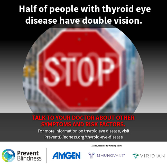 PB_Ohio's tweet image. This week is Thyroid Eye Disease Awareness Week! 
For more information on TED, visit: preventblindness.org/thyroid-eye-di…