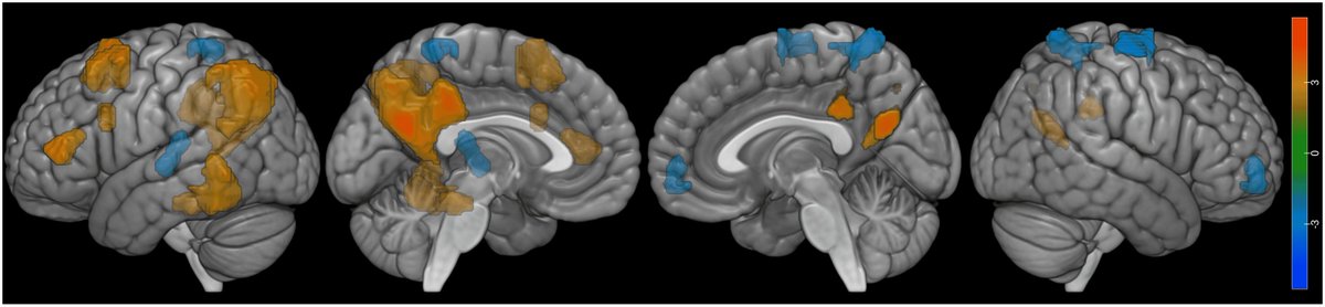 Neurobiology of Language (@jneurolang) on Twitter photo Neural Correlates of Object-Extracted Relative Clause Processing Across English and Chinese | doi.org/10.1162/nol_a_… | by <a href="/graydunagan/">donald gray dunagan</a>, <a href="/milosstanojevic/">Miloš Stanojević</a>, @max_i_min, <a href="/shulin_zh/">Shulin Zhang</a>, <a href="/shohini_tahini/">Shohini Bhattasali (শোহিণী)</a>, <a href="/jixingli/">Jixing Li</a>, <a href="/jonrbrennan/">Jonathan Brennan</a> & John Hale Neural Correlates of Object-Extracted Relative Clause Processing Across English and Chinese | doi.org/10.1162/nol_a_… | by <a href="/graydunagan/">donald gray dunagan</a>, <a href="/milosstanojevic/">Miloš Stanojević</a>, @max_i_min, <a href="/shulin_zh/">Shulin Zhang</a>, <a href="/shohini_tahini/">Shohini Bhattasali (শোহিণী)</a>, <a href="/jixingli/">Jixing Li</a>, <a href="/jonrbrennan/">Jonathan Brennan</a> & John Hale