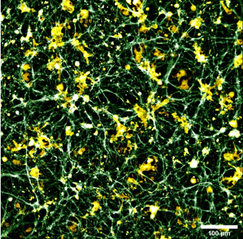 Proteintech's tweet photo. Want to try our popular #Iba1 antibody and get beautiful images like this?
Visit booth 1705 at #SfN23 to check out our free samples
Image credit: @himanishbasu from @harvardmed
Product: https://t.co/7F5KFDm7qS
#microglia #neuroinflammation #neuroscience #immunofluorescence https://t.co/O1dRlNxYyB