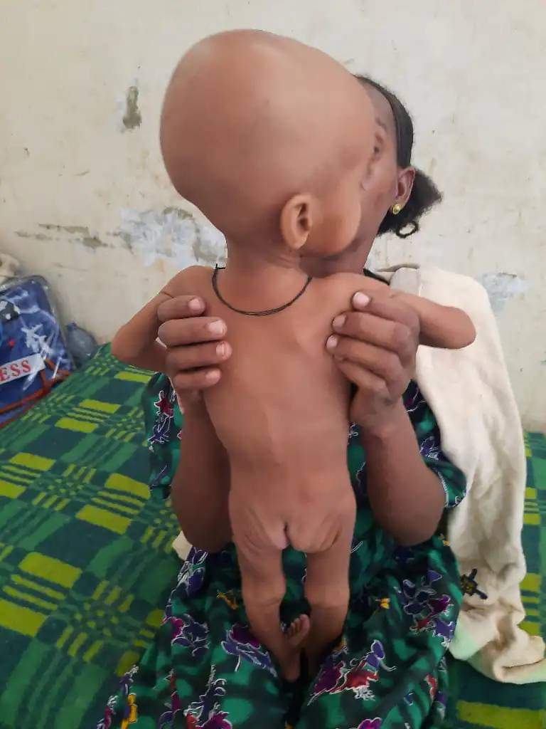 TigrayUpdate's tweet photo. Famine in Abergele

"Abergele, Atsbi and Raya are the most drought affected areas of Tigray and need special attention to save lives."

@UN's @WFP and @StateDept's @USAID have halted distribution of humanitarian aid to #Tigray since March 2023.

Image via Mulu Tazeze
🔗https://t.co/sNQlo1OwSx
🔗https://t.co/KAudZKO3MB

#Ethiopia & #Eritrea are guilty of #TigrayGenocide