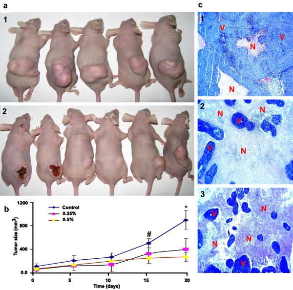 DrFarazHarsini's tweet photo. 🚨 Please RT and encourage Maastricht University to stop promoting bad science. 

😞 We're disappointed to see @MaastrichtU taking a step back and promoting ineffective, outdated, cruel, and unethical methods in science (see comments).

🐁 Results from animal testing can be misleading and not generalizable to humans, meaning it harms humans as well.

Once you cross species barrier there will be external validity issues that you can never overcome with animal testing.

⏩ Even when drugs are shown to be 100% safe in other primates they can cause severe reactions in humans and potentially kill them (TGN1412 drug trial for instance).

🤔 Will we learn something new when we test on animals?

Sure, we learn something new with any experiment. But the question is how valid and applicable those results are in humans and in what cost are we getting these results?

☠️ At its core, it's also cruel, and I say that as someone who was involved in preclinical research for cancer, infectious diseases, and inflammation.

🙄 Let me tell you something that no one else would from inside. When they talk about animal testing they always show you a cute mouse just like what they did here in their original post.

The truth is even if they try to cause less pain, it's still a torturous process for animals.

🙈 Imagine being genetically manipulated, born in captivity, taken away from your parents, getting injections or being handled by experimenters everyday, living your life in isolation and in constant distress and depression, with infectious diseases, burns, cancer (so consistently in pain and distress), and then getting killed.

Imagine that be your experience from your precious life. 

I always say if you won't give me your pet to do this to them, then you already know animal testing is unethical. 

In a very simple and basic experiment tens to hundreds of mice or other animals have to be tortured, to become a figure on a paper like the picture shown here. 

Can you imagine the life those animals had while they were developing those giant artificial tumors? 

😞 All of this torture to get results that will not be applicable to humans, unless by accident. Yet the alternatives are actually human relevant and safe.

✅ If good alternatives don't exist, the aproach should be to fund more research to develop better alternatives, not to continue an outdated and cruel tradition.

Better alternatives are safer, faster, and cheaper. Better for us, better for other animals. Win-win. 

@PCRM @thePSCI @ShalinGala @alkac1 @RyanWMerkley @jhucaat @ToxmasHartung
