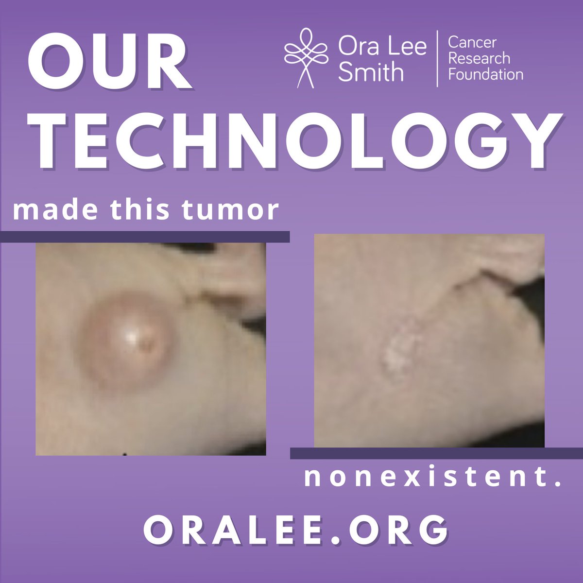 OraLeeOrg's tweet image. Founded by @drhadiyahgreen, @oraleeorg has cancer-killing #tech that eliminates tumors in lab mice after one 10-min session in just 15 days. Your support will fund clinical trials &amp;amp; keep our tech affordable for all. Learn more and donate at OraLee.org.
