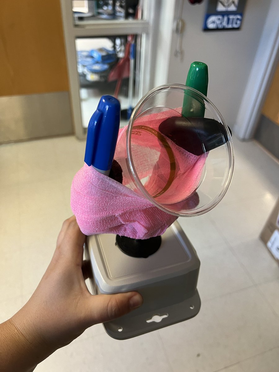 DanielleCTRS's tweet image. This gamer presents with a stump and limited range of of motion, but they want to play Mario Kart! Please enjoy our first prototype towards creating a custom joystick topper. Their stump fit perfectly and gave them full use of the joystick #Xbox #XboxAdaptiveController #Gaming