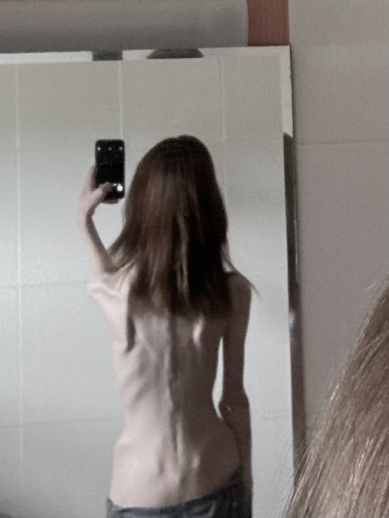 lassquelette's tweet image. i don’t care how crazy ppl think i am, i refuse to let them take this from me. i’ve not been comfortable in my body ever in my life, not until getting to this weight. when i look in the mirror now, it shows the real me, it feels like me for the forst tume ever. it felt wrong b4..