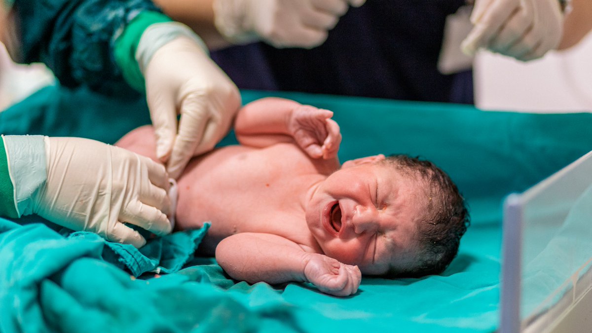 Hudson_Research's tweet photo. #CordBlood stem cells are an important medical therapy used to treat patients in need of a stem cell transplant, with over 40,000 transplants conducted so far. 💉Yet most of the general public is not aware of the need to preserve this valuable natural resource.🩸 https://t.co/Fl1YVeZzr4