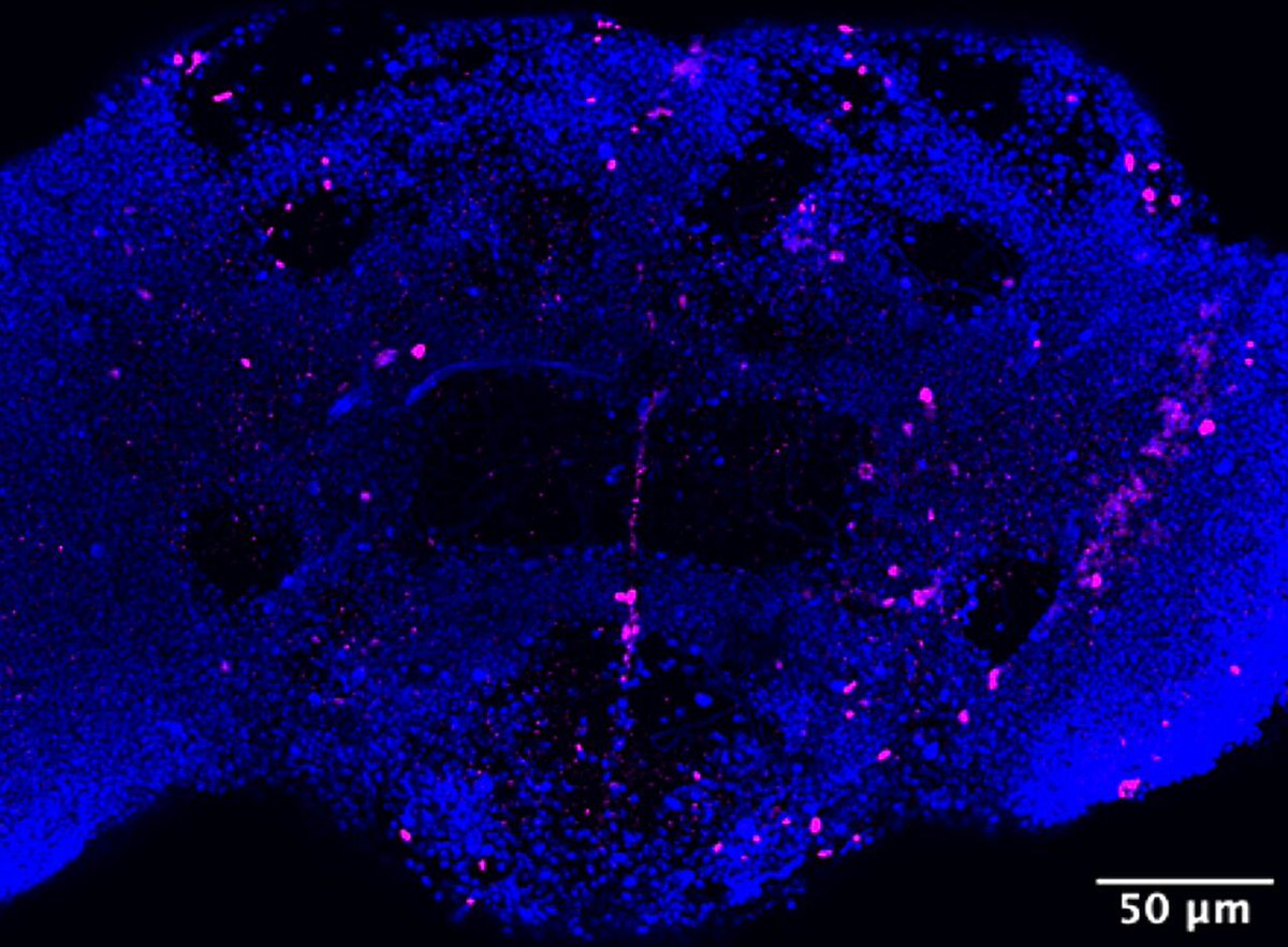 talius's tweet photo. An #Immune #Molecule that Regulates #Aging and a Living Organism's #Lifespan
Using Drosophila flies, a novel immune modulator #IM33 was found to mediate glia-gut-neuronal axis that controls lifespan. See more... https://t.co/AODCY9idmQ https://t.co/BAsmVKm0Dh
