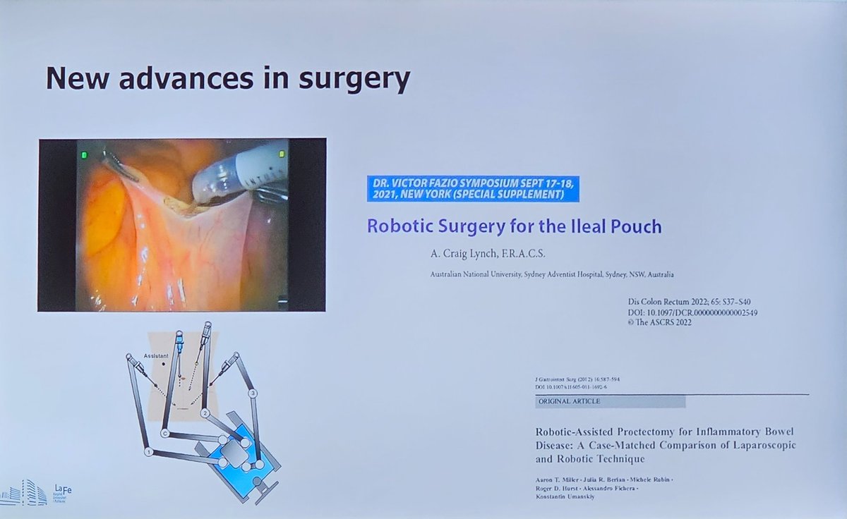drRobinDud's tweet photo. Surgery in #UlcerativeColitis
by Menia Mlan @monicamillan72
#FALK235 🇪🇸 #Madrid2023
#IBD #colitis https://t.co/J8IO5MXYTs