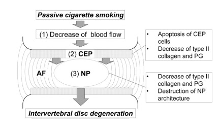 Smoking causes intervertebral disc degeneration by 
1️⃣ Death of cartilage end plate (CEP) cells 
2️⃣ Destruction of type II collagen
3️⃣ Destruction of proteoglycans

Occurs in smokers AND passive smokers
 
Stopping smoking does NOT cause disc regeneration.

sciencedirect.com/science/articl…