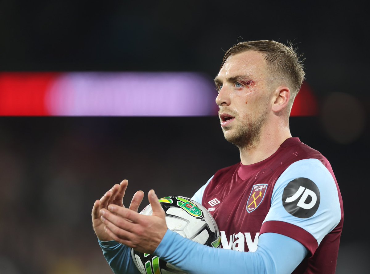 HammersNetwork's tweet photo. Who was your West Ham Player of the Month for October? https://t.co/cRVacHFBgN