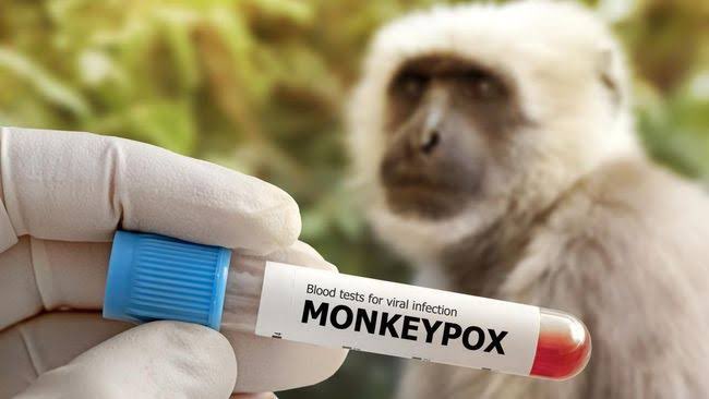 agungmrheza's tweet photo. ***UPDATE MONKEYPOX***

Berikut adalah situasi terkini virus monkeypox (MPXV) di dunia dan Indonesia. Data didapatkan dari WHO, Kemenkes, dan sumber lain.

• sebuah utas ganda mengusung "One Health" bersama dengan @vkarr13 dari pov dokter hewan • https://t.co/obwi9muyUt