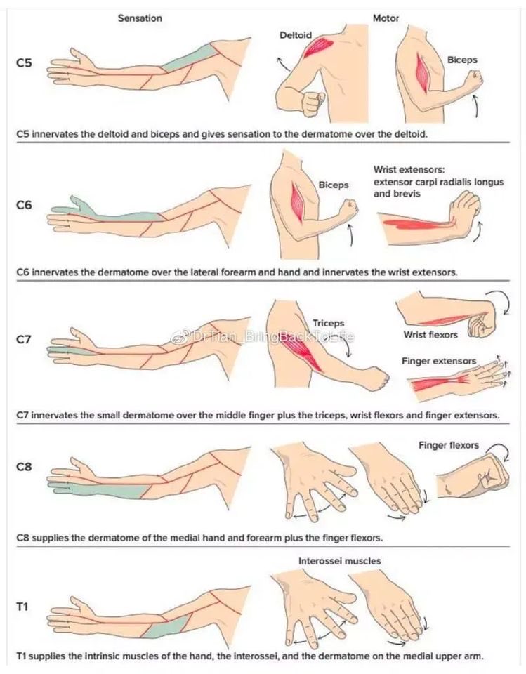 OGdukeneurosurg's tweet photo. Neuro exam arm https://t.co/ZFIEXnah5l