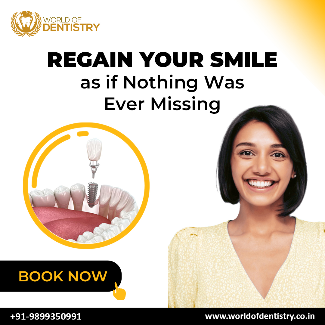 Rediscover Your Smile, Complete and Radiant! 😁✨ Say Goodbye to Gaps and Hello to Confidence.

#dentalcare #SmileRestoration #regainyoursmile #CompleteSmile #dentalmagic #ConfidentSmile #oralhealth #cosmeticdentistry #smileagain #dentist #dentistry