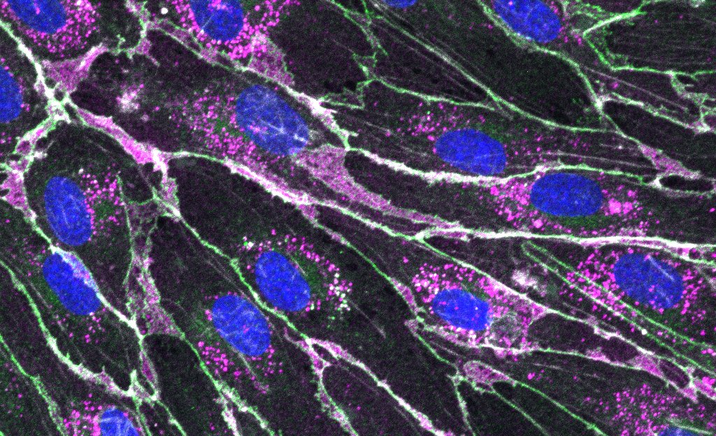 CSIC_VAACT's tweet photo. 📢Un estudio @SaludglobalCSIC identifica posibles #tratamientos combinados para preservar la #microvasculaturapulmonar durante enfermedades inflamatorias sistémicas como #septicemia o #COVID19.
https://t.co/iDCMo45l9q
#PTI https://t.co/GWzLzI4WwZ