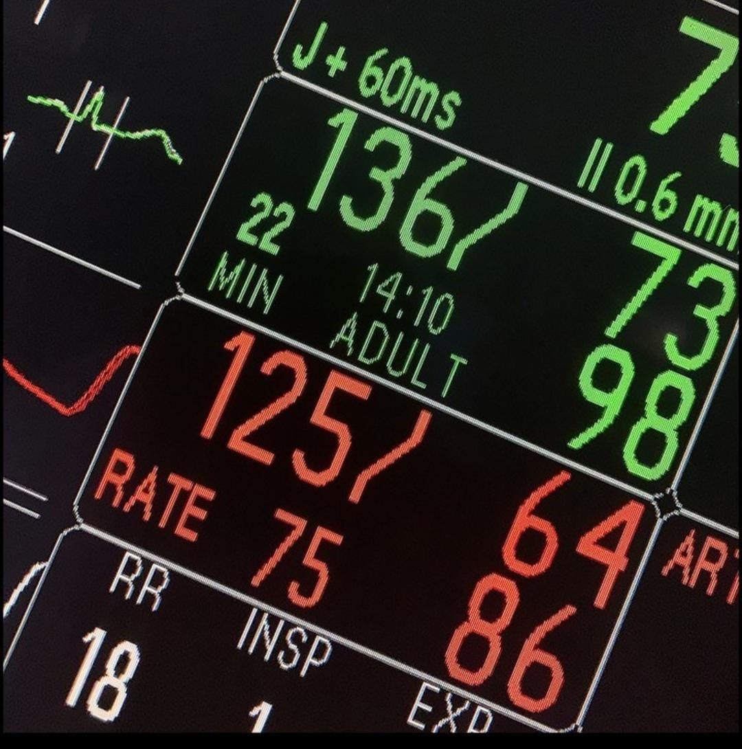 snwhealth's tweet image. Compared to intermittent oscillometric arterial pressure monitoring.

Link -
pubmed.ncbi.nlm.nih.gov/37265355/#:~:t….

#Anesthesiology #Anesthesiologist #MedicalResearch #snwhealth #snwareresearch