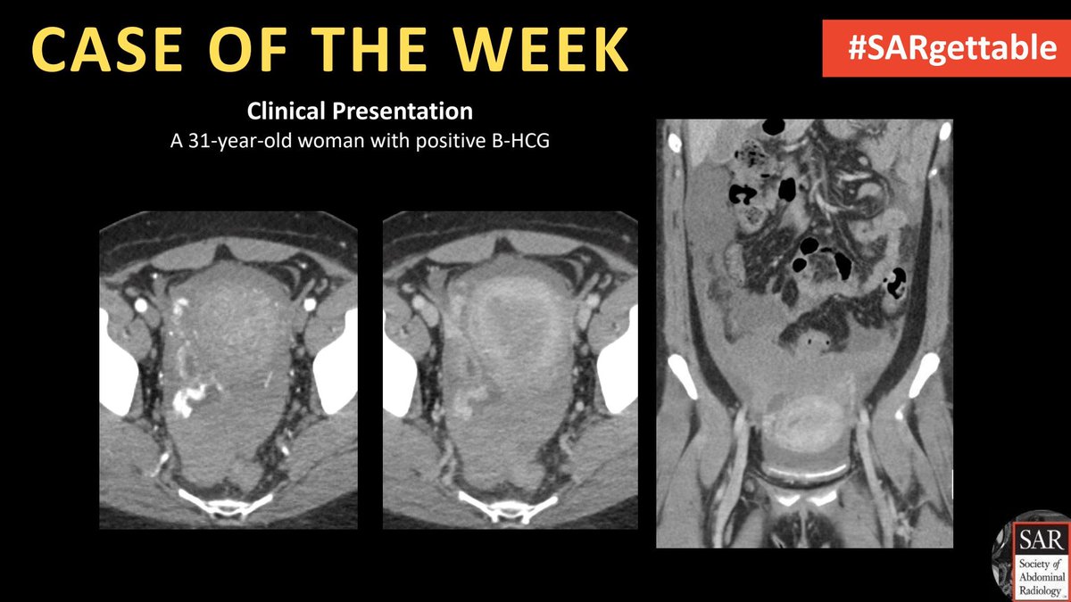 It's time for a new #SARgettable case of the week contributed by @ItaniMalak and @MIRimaging! Comment with your diagnosis down below!