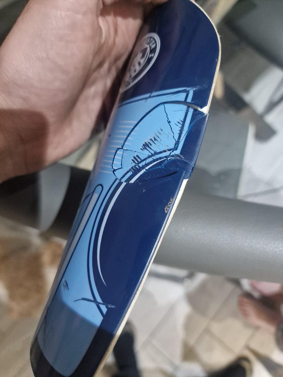 No Shins No Game

Our CWO is always going on about shin pads and how we must wear them for training and games, today one of our U12s was able to demonstrate why they are so important! When 2 players went for the ball everyone heard an almighty thud, later this is what our player