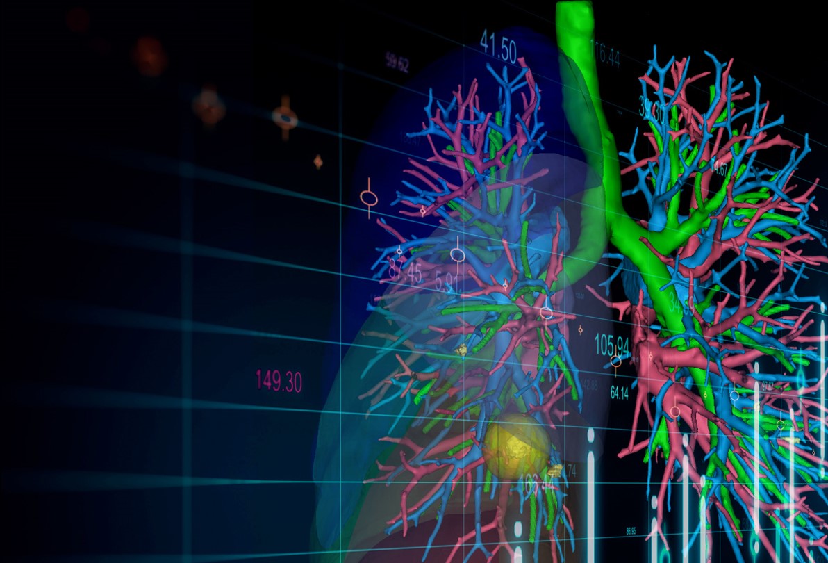 Paid Ad - Want to start, scale, or improve your segmentectomy procedures? Dive into the world of 3D preoperative planning with Materialise at Booth 108 at the STSA Annual Meeting November 2 – 5 — and see how Mimics Planner can help you. materialise.com/en/healthcare/…