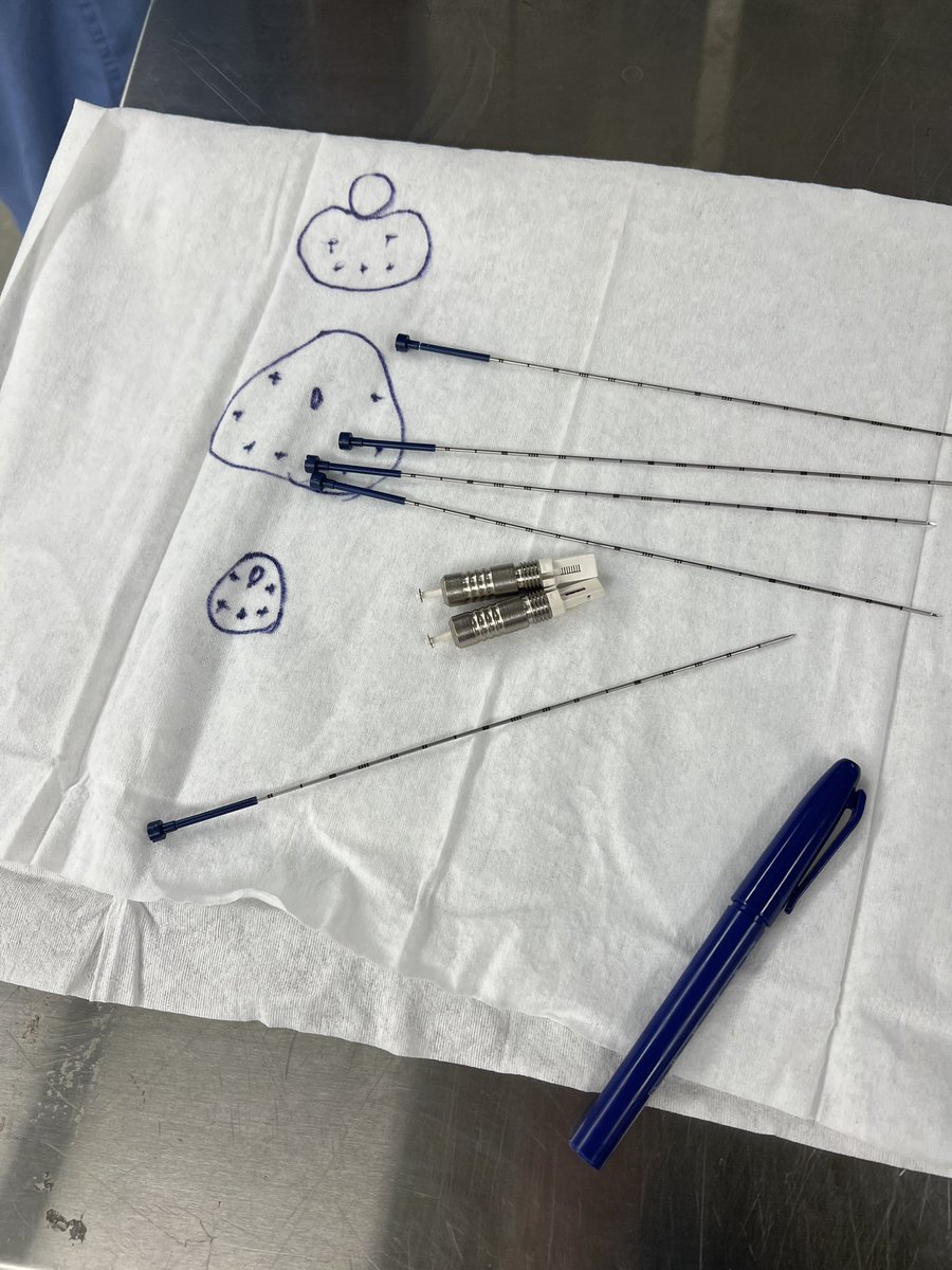 marisa kollmeier (@marisakollmeier) on Twitter photo Well that was FUN! Taking advantage of available OR time- hands on LDR prostate brachytherapy workshop with our fellows and MP resident ā¢ļøš±<a href="/MSK_RadOnc/">Memorial Sloan Kettering Radiation Oncology</a> #brachytherapy #mskcc Well that was FUN! Taking advantage of available OR time- hands on LDR prostate brachytherapy workshop with our fellows and MP resident ā¢ļøš±<a href="/MSK_RadOnc/">Memorial Sloan Kettering Radiation Oncology</a> #brachytherapy #mskcc