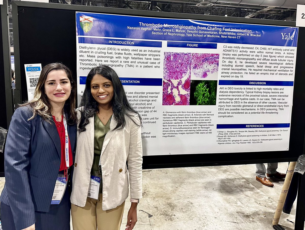 Yale Nephrology (@yalenephrology) on Twitter photo Another day of fellow posters by 2nd years <a href="/nora_hg/">Nora Hernández</a> and Naz Mehr, along with their faculty mentors <a href="/brewster_ursula/">Ursula Brewster</a>, <a href="/DeepthiGunasek1/">Deepthi Gunasekaran</a>, and Sue Crowley! <a href="/ASNKidney/">American Society of Nephrology</a> #KidneyWk Another day of fellow posters by 2nd years <a href="/nora_hg/">Nora Hernández</a> and Naz Mehr, along with their faculty mentors <a href="/brewster_ursula/">Ursula Brewster</a>, <a href="/DeepthiGunasek1/">Deepthi Gunasekaran</a>, and Sue Crowley! <a href="/ASNKidney/">American Society of Nephrology</a> #KidneyWk