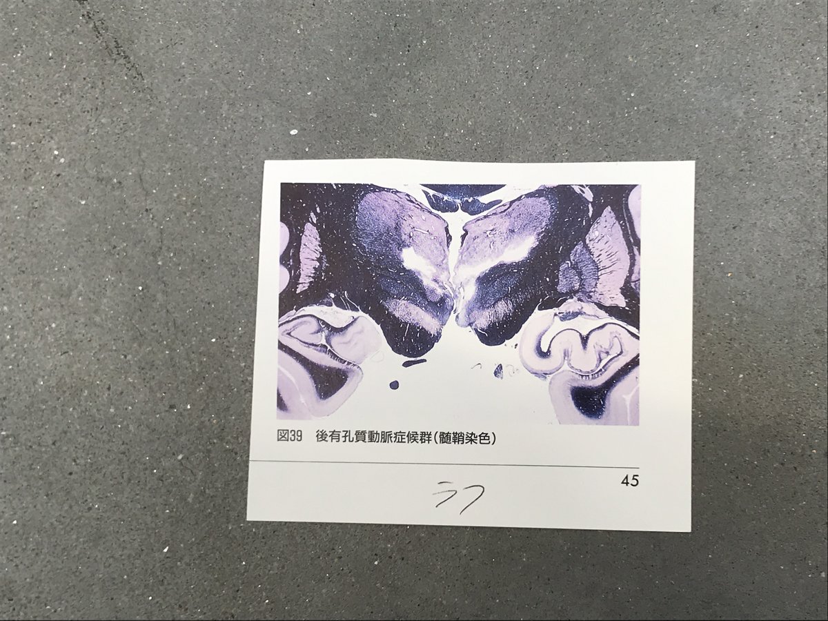 公式】低FODMAPプロテイン｜FODUP（フォドアップ） (@fodup_official) • Instagram photos and  videos, image size:1200x900