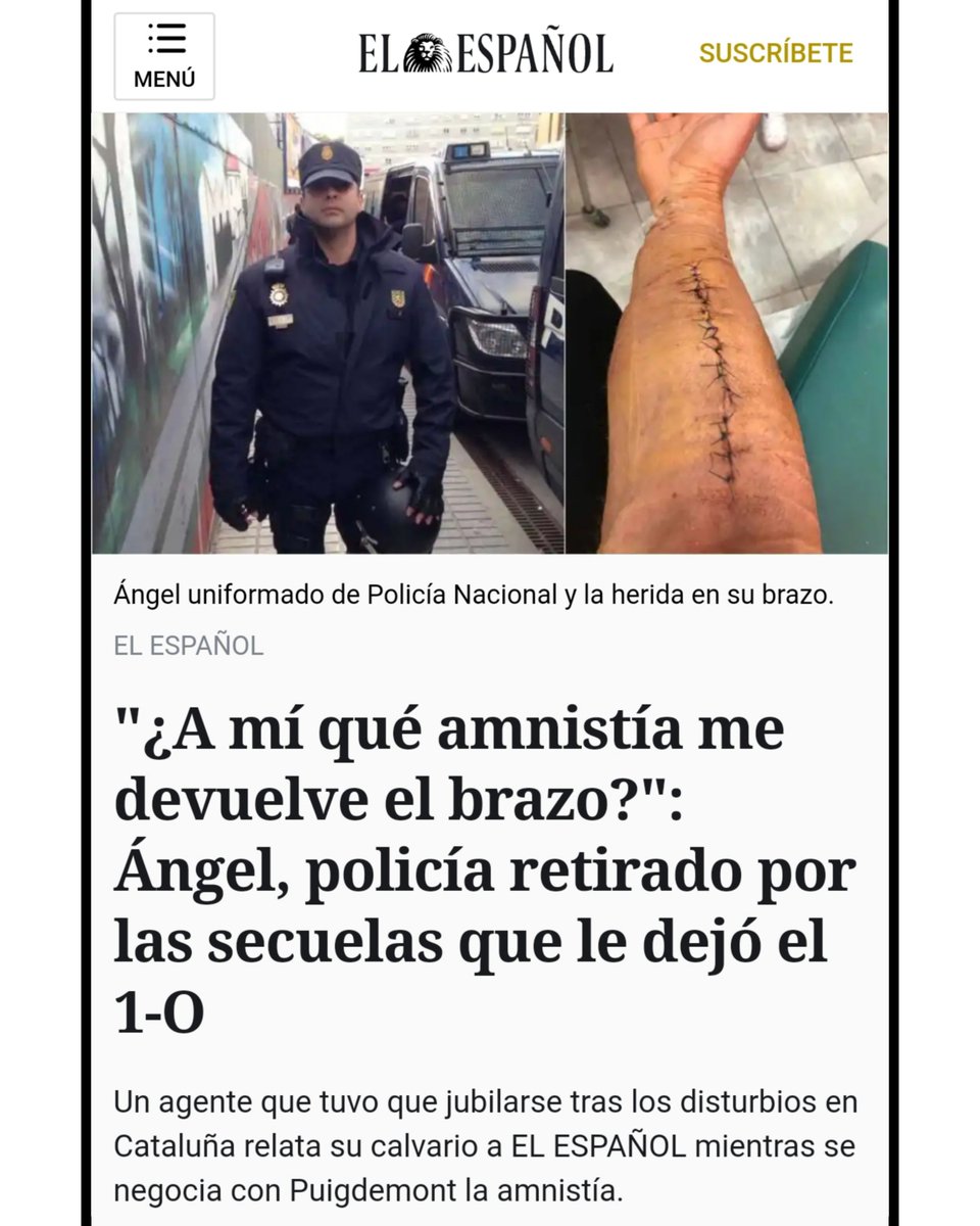 «¿A mí qué amnistía me devuelve el brazo?».