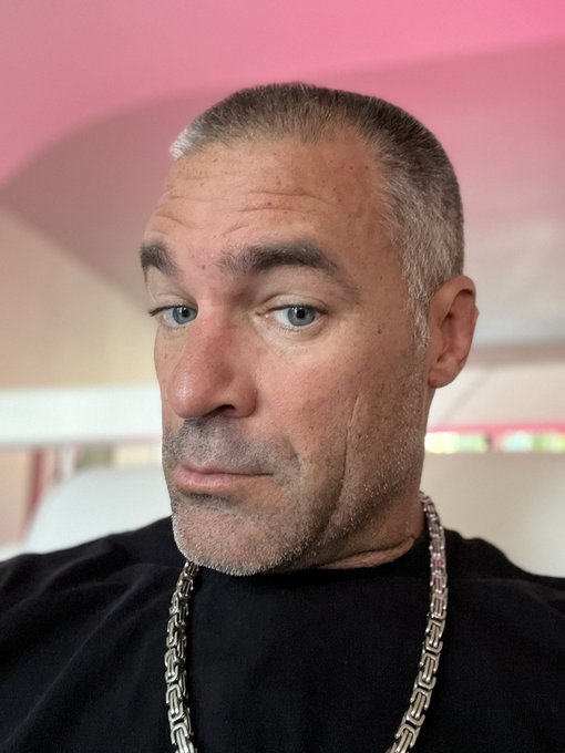 I just got a hair transplant. They took the hair from my upper lip and stuck it on my head. Studshit<a href="/tag/subscribersonly"class="tags"><span>#subscribersonly</span></a>