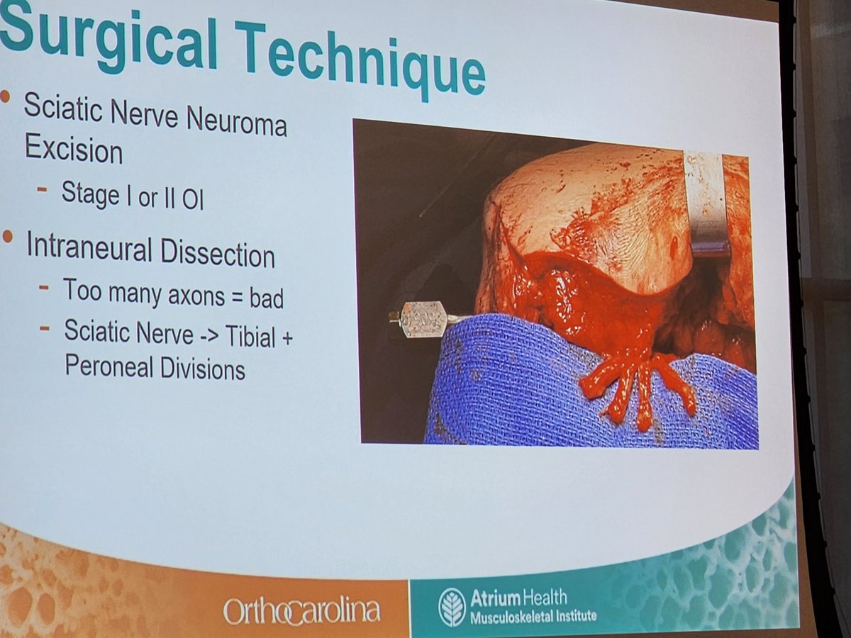 Kirby Bonvillian presenting on #RPNI for #osseointegration @AtriumOrthoRes @OrthoCarolina @AtriumMSKI 
@GCCO_CLT #GCCO2023
@CMC_OrthoRes