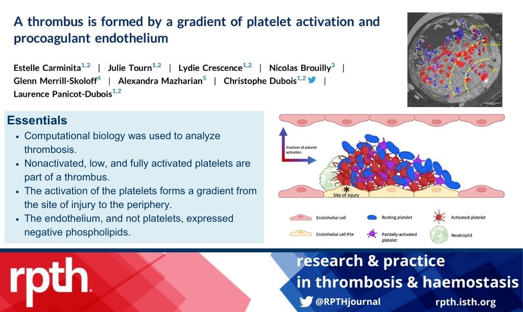 RPTH (@rpthjournal) on Twitter photo In vivo microscopy and computational biology reveal that #platelets have different activation states within the thrombus in a laser-induced #thrombosis model #RPTH <a href="/chris_dubois13/">Christophe Dubois</a> @julietourn @ecarminita @lydiecrescence @alexandraMaz1 tinyurl.com/57xkj864 In vivo microscopy and computational biology reveal that #platelets have different activation states within the thrombus in a laser-induced #thrombosis model #RPTH <a href="/chris_dubois13/">Christophe Dubois</a> @julietourn @ecarminita @lydiecrescence @alexandraMaz1 tinyurl.com/57xkj864