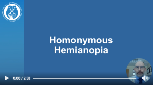 NANOSTweets's tweet photo. #Homonymous #Hemianopia: Vision loss on one side of both eyes due to brain damage, not eye issues.
Read more here: https://t.co/7PzhvtKsYe
Watch Video Here: https://t.co/11feRjLiN4
#Health #VisionLoss #ophthalmologyjobs #nanos https://t.co/uMF4UoPig8