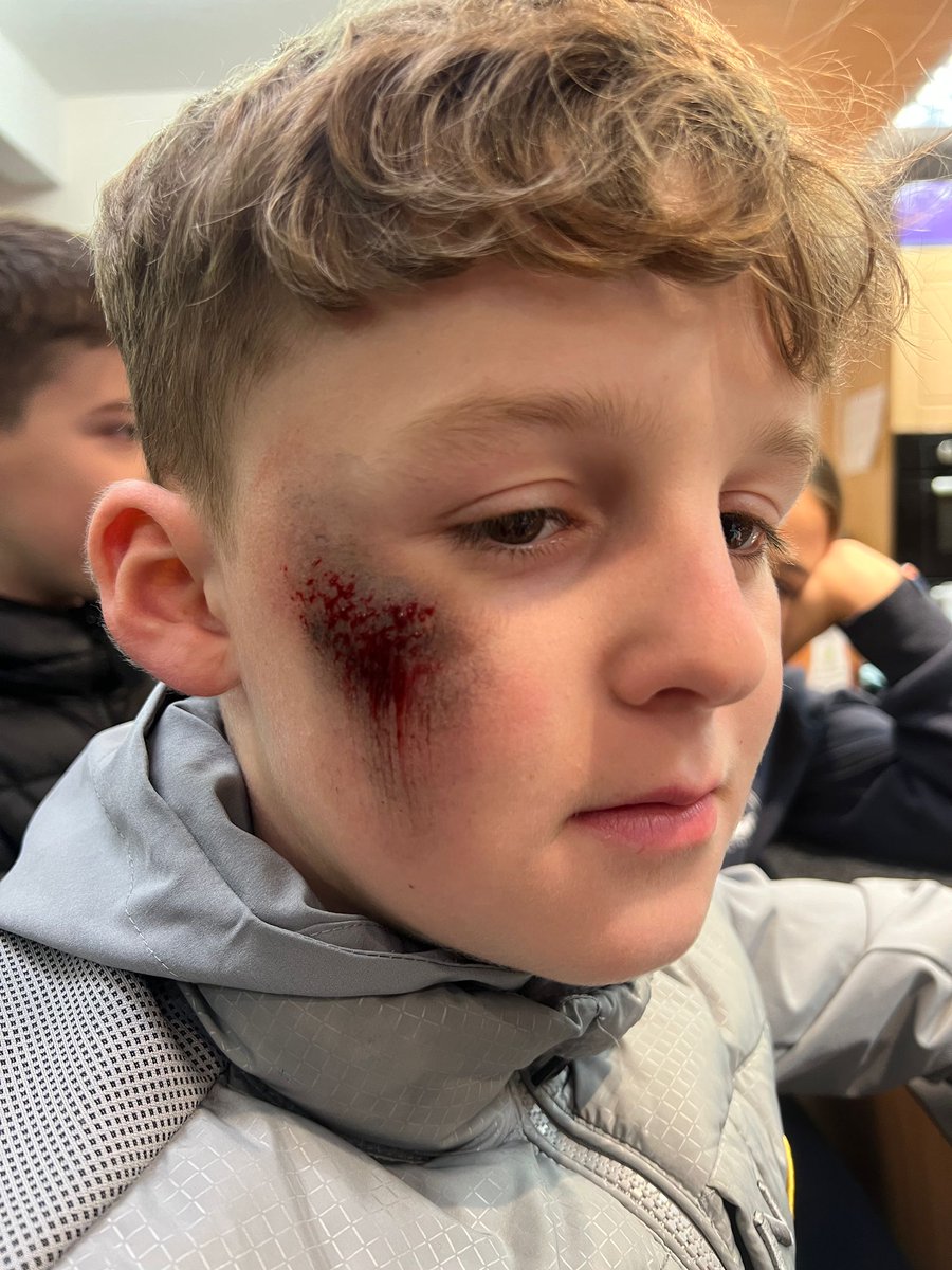 Young people at #Rothwell Windmill Youth clubs have discussed firework and Bonfire safety this week. 

They have used special FX make up to illustrate injuries caused by throwing fireworks. 

They have also been creative doing Halloween themed art. 🎃

#youthworkleeds
