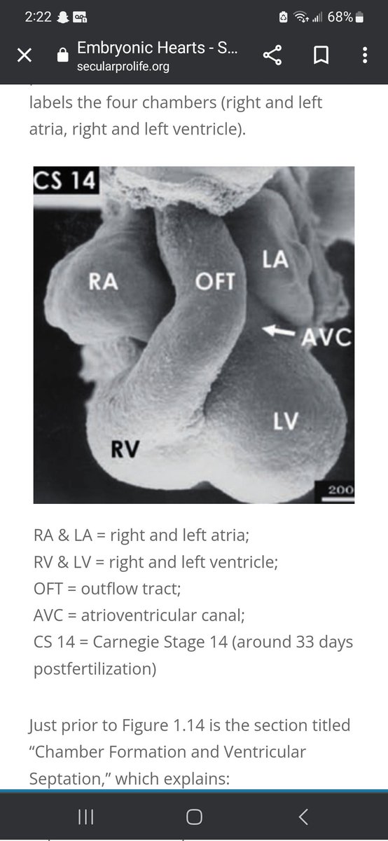 By 6-7 weeks LMP (4-5 weeks post-fertilization), the embryo has:

1) a chambered heart
2) using coordinated muscle contractions
3) to unidirectionally pump blood
through veins
4) to exchange oxygen and carbon dioxide.

RA & LA = right and left atria;
RV & LV = right and left…
