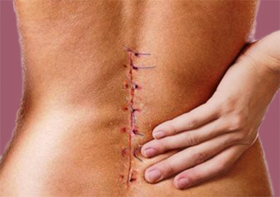 TriangleDecompr's tweet image. Back surgery is sometimes necessary, but it should rarely be the first choice! Triangle Spinal Decompression treats patients conservatively with very positive results! In most cases, patients avoid spinal surgery all together!
 
#spinaldecompressiontherapy #spinaldecompression