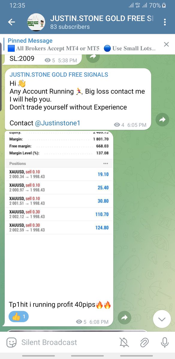 mrJustin1195513's tweet photo. Gold
Come to join my channel

https://t.co/6uM0piI3Lm

#GOLD #XAUUSD 
https://t.co/6uM0piI3Lm… 
like that huh? 😘😘

Enjoy your profit guysss 🔥 https://t.co/lKTN3qzipo