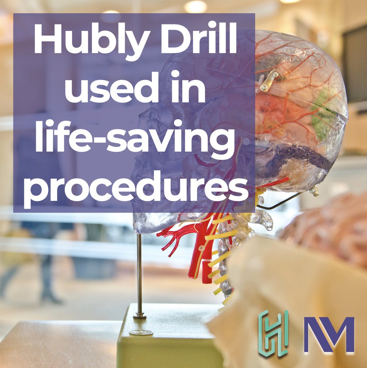 Hubly Surgical (@hublysurgical) on Twitter photo Dr. Matthew Potts at <a href="/NorthwesternMed/">Northwestern Medicine</a> successfully demonstrated Hubly Drill's SMART bedside Auto-Stop for the first time in patients!
Read more: hublysurgical.com/2023/11/02/hub…
#Neurosurgery #CranialSurgery #MedicalDevices #NeuroTech #NeuroICU #CranialDrill #SurgicalInnovation Dr. Matthew Potts at <a href="/NorthwesternMed/">Northwestern Medicine</a> successfully demonstrated Hubly Drill's SMART bedside Auto-Stop for the first time in patients!
Read more: hublysurgical.com/2023/11/02/hub…
#Neurosurgery #CranialSurgery #MedicalDevices #NeuroTech #NeuroICU #CranialDrill #SurgicalInnovation