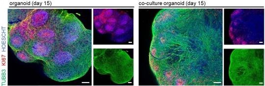 🥼 Dr. Floren Ginhoux (<a href="/FGinhoux/">@realFlorentGinhoux</a>) and team at <a href="/astar_research/">A*STAR Research</a> generated #microglia-sufficient #brain organoids by 🧫 coculturing brain #organoids with primitive-like #macrophages generated from the same human induced pluripotent stem cells.

🔗 bitly.ws/ZhAv